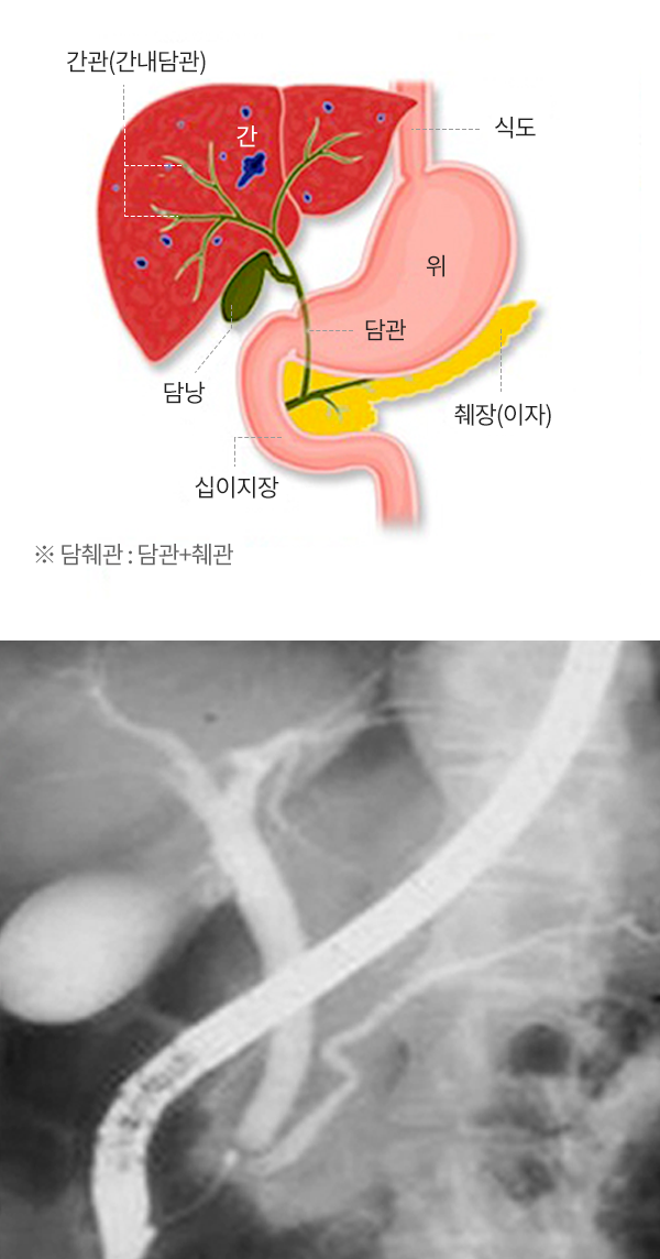 간관(간내담관), 식도, 담낭, 담관, 위, 십이지장, 췌장(이자) ※담췌관 : 담관 + 췌관