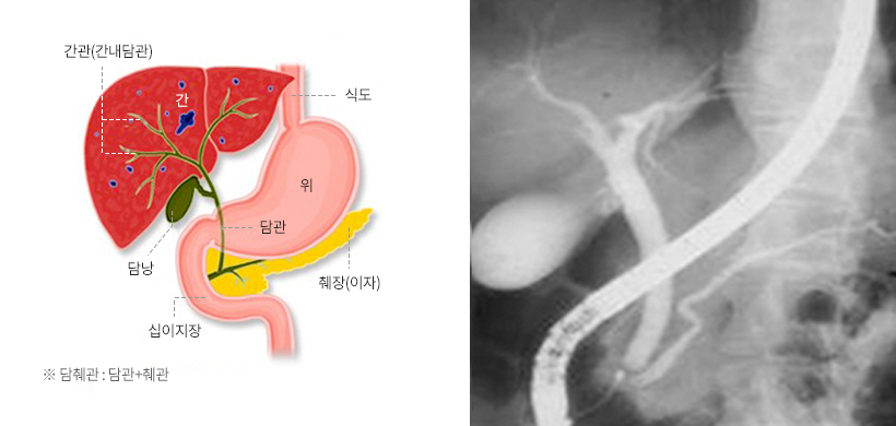 간관(간내담관), 식도, 담낭, 담관, 위, 십이지장, 췌장(이자) ※담췌관 : 담관 + 췌관